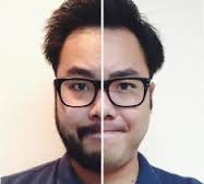 Problèmes de barbe chez les hommes d’origine asiatique