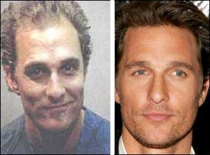 greffe-cheveux-Matthew-McConaughey