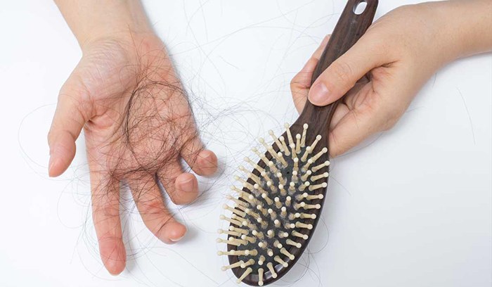 Ce que la perte de cheveux est en train de vous dire