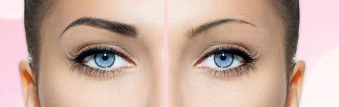 Quelles sont les causes de chute des sourcils ?