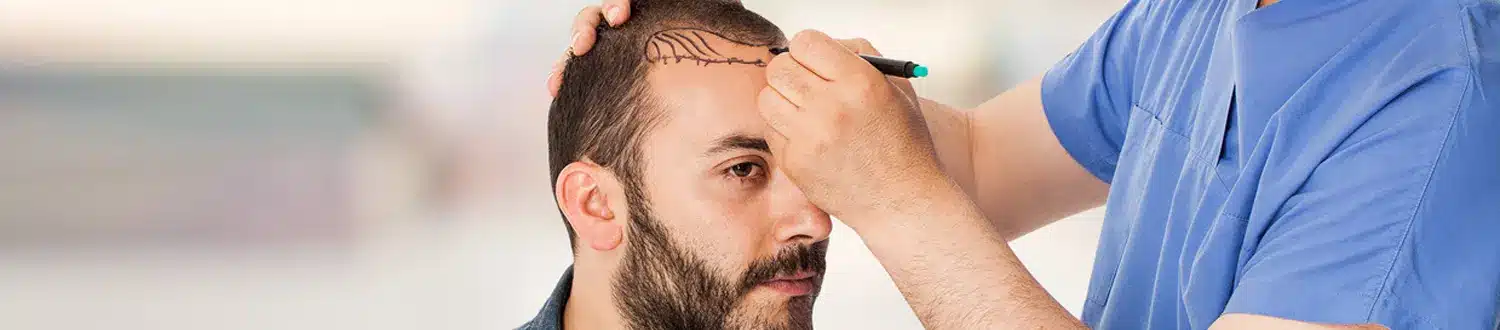 مصحة زراعة الشعر تونس