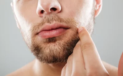 Questions au sujet de ‘l’après-greffe de barbe’