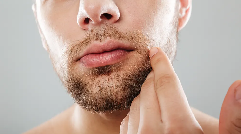 apres-greffe-barbe