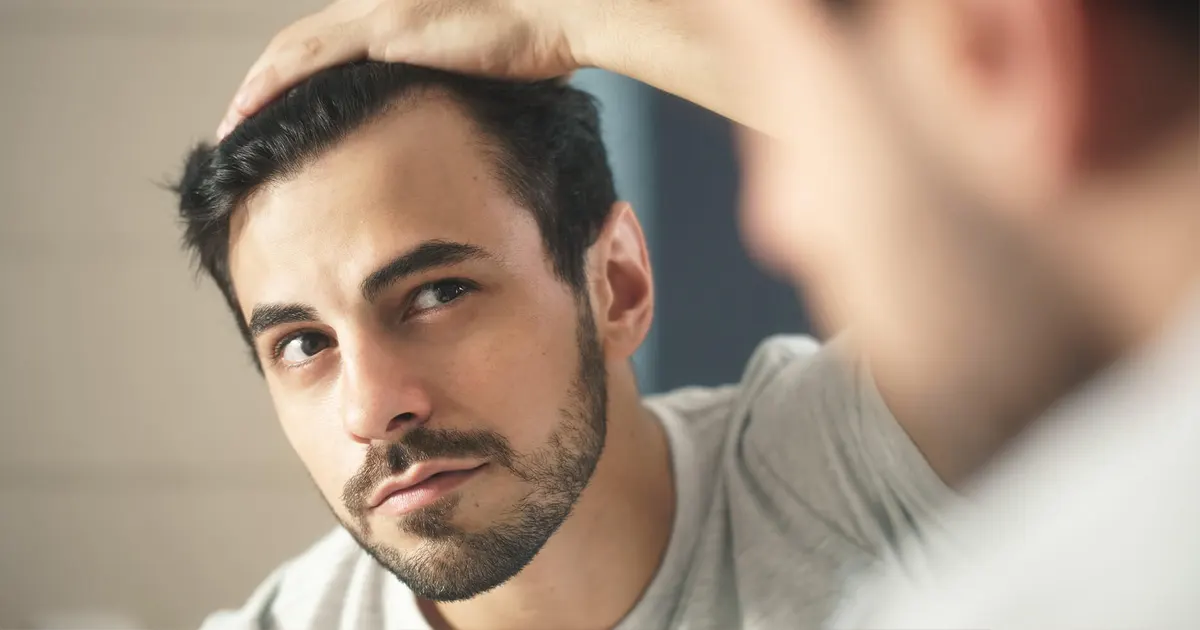 chute-de-cheveux-homme