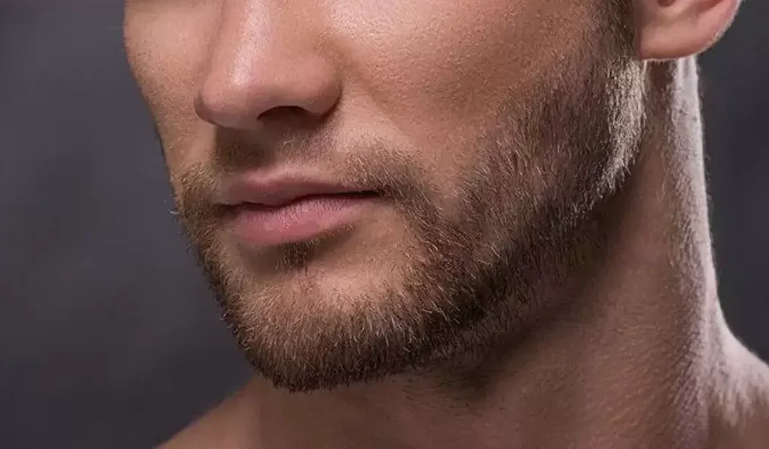 greffe de la moustache