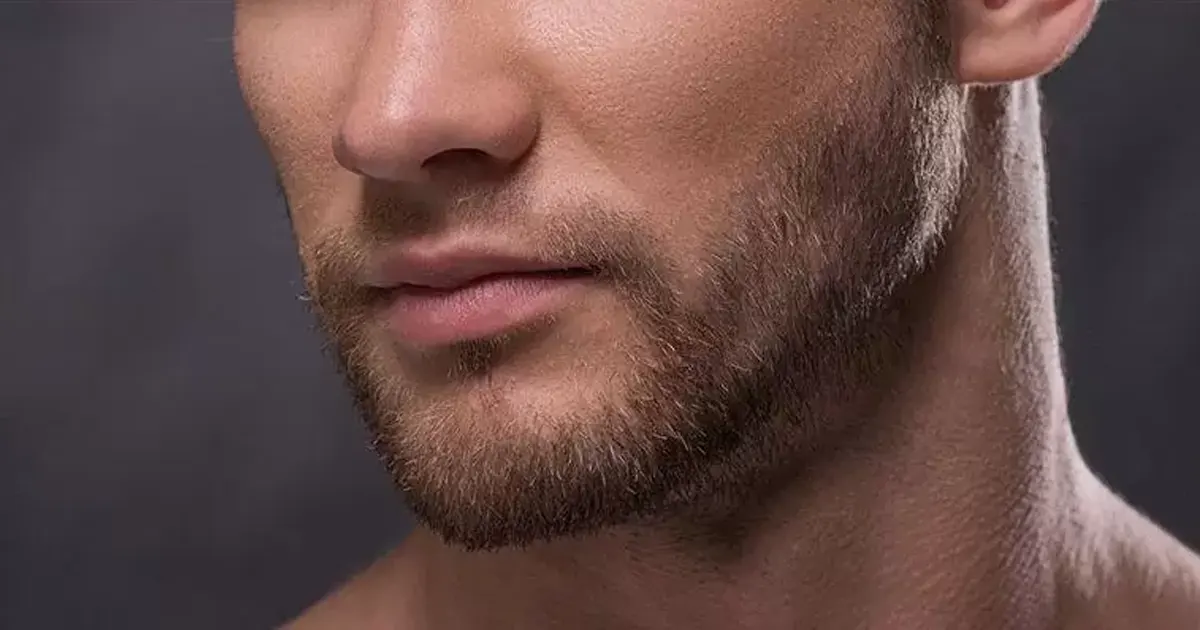 greffe de la moustache