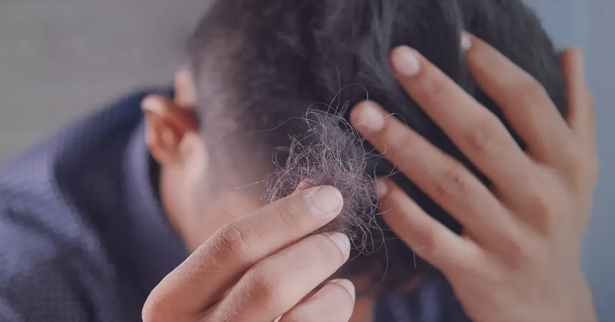 Comment savoir si la chute de cheveux est normale ou pathologique ?