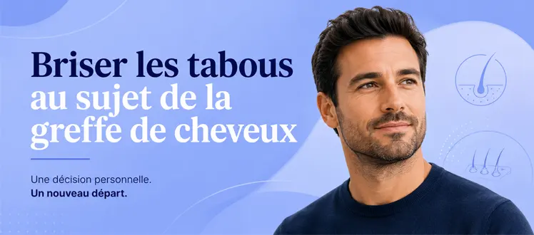 Briser les tabous au sujet de la greffe de cheveux
