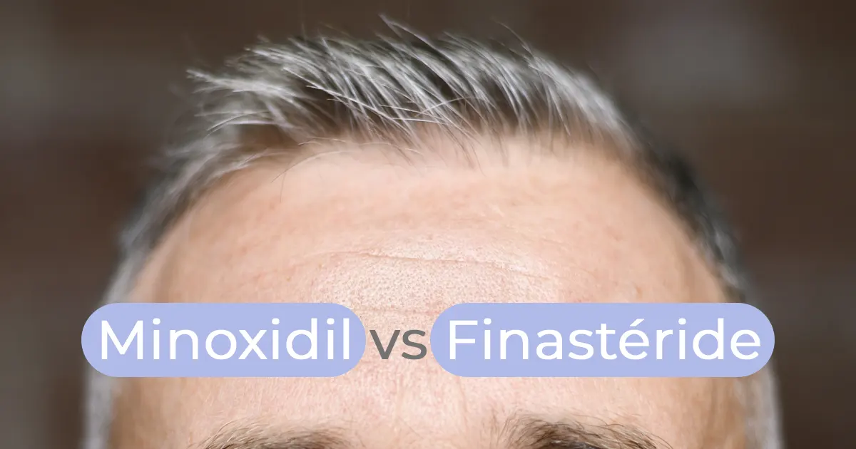 Minoxidil-Finastéride