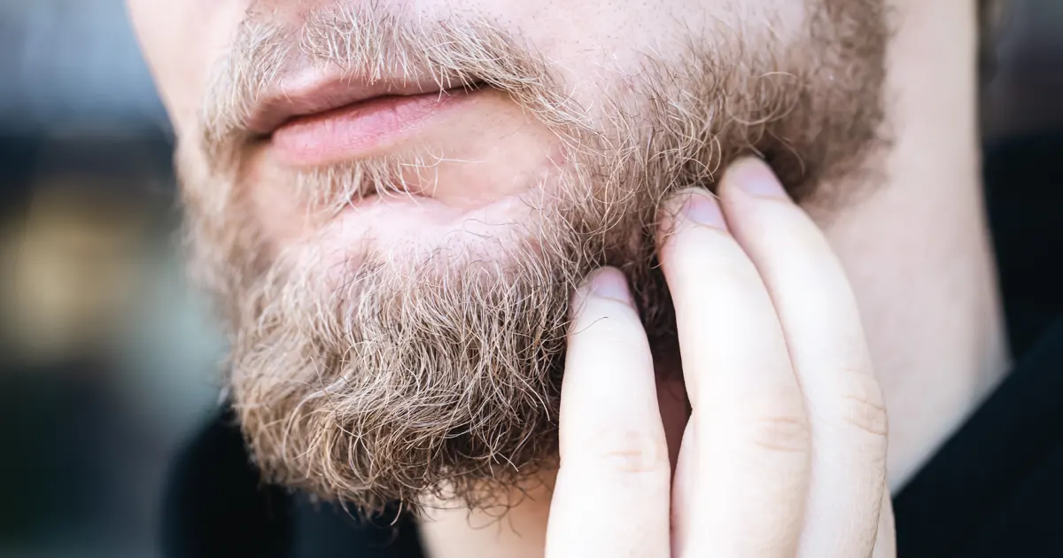 la greffe de barbe et de moustache